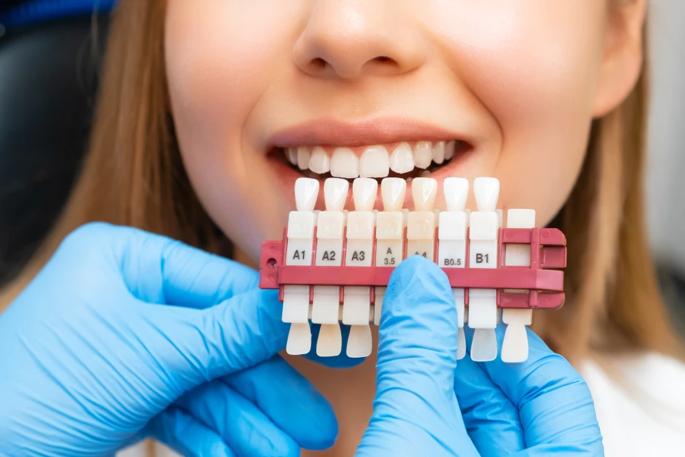 Teeth whitening Miami Beach