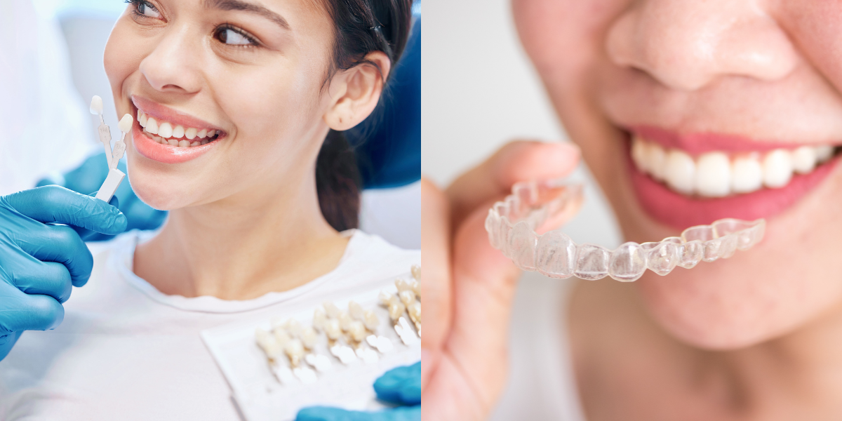 Can You Get Veneers If Your Teeth Are Crooked, or Do You Need Invisalign First?