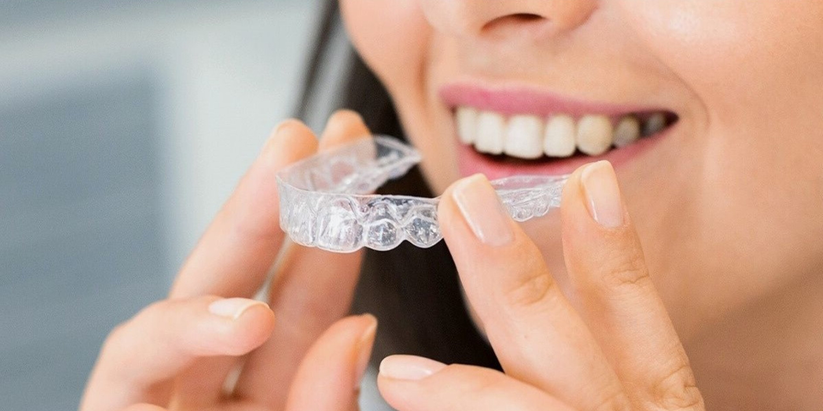 How Long Does Invisalign Take in Miami Beach? Real Timelines Explained