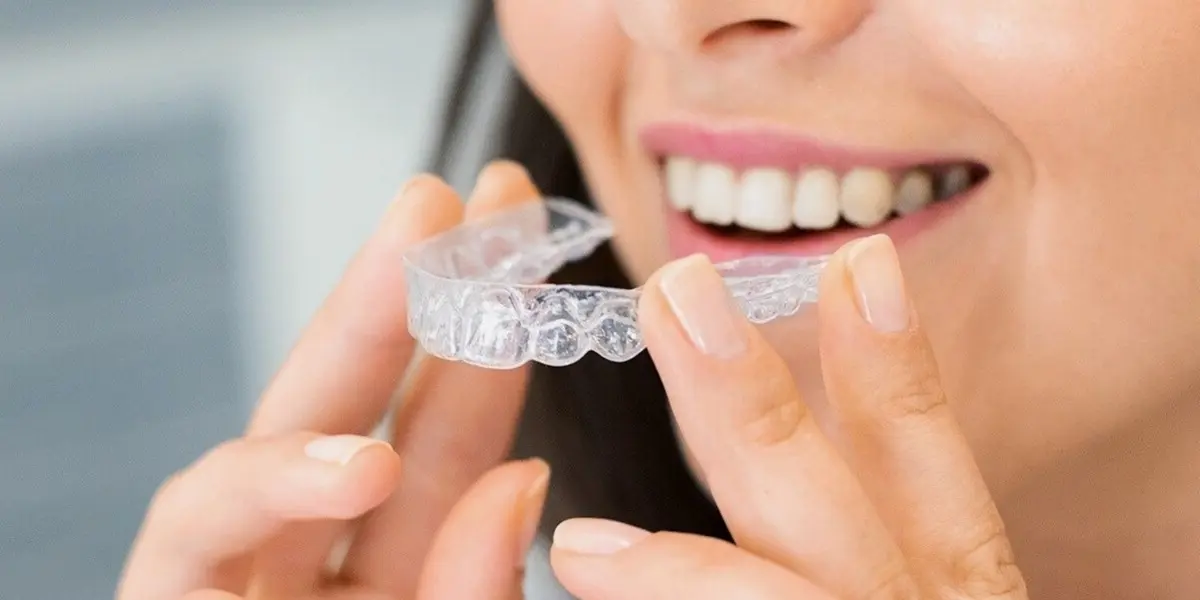 How Long Does Invisalign Take in Miami Beach? Real Timelines Explained