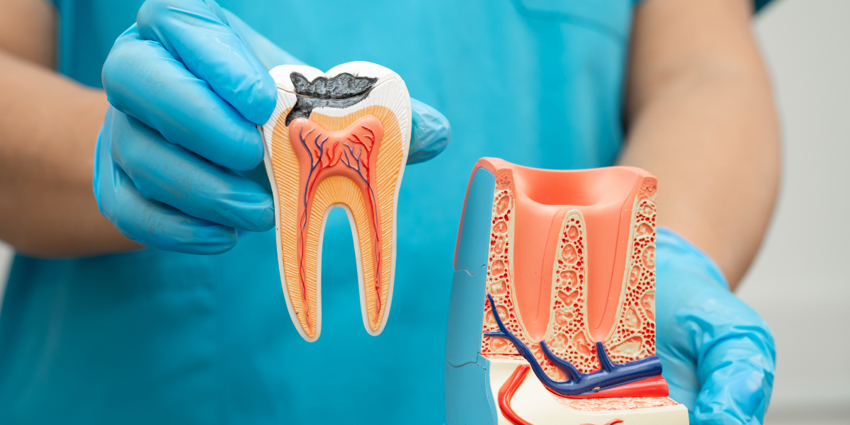 Tooth Pain Gone Suddenly: Do You Still Need A Root Canal?