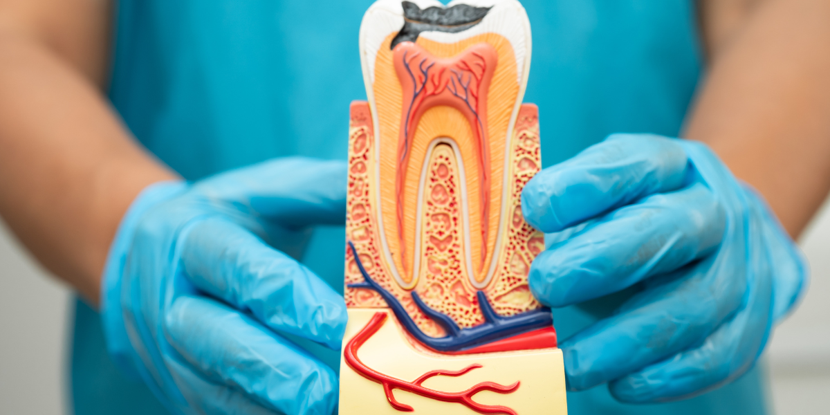 Where to Get Emergency Root Canal in Miami Beach