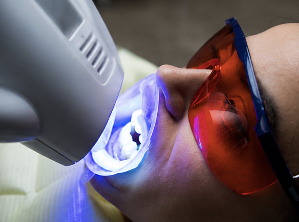 Philips Zoom 4 WhiteSpeed LED whitening device at Cupo Dental Miami Beach