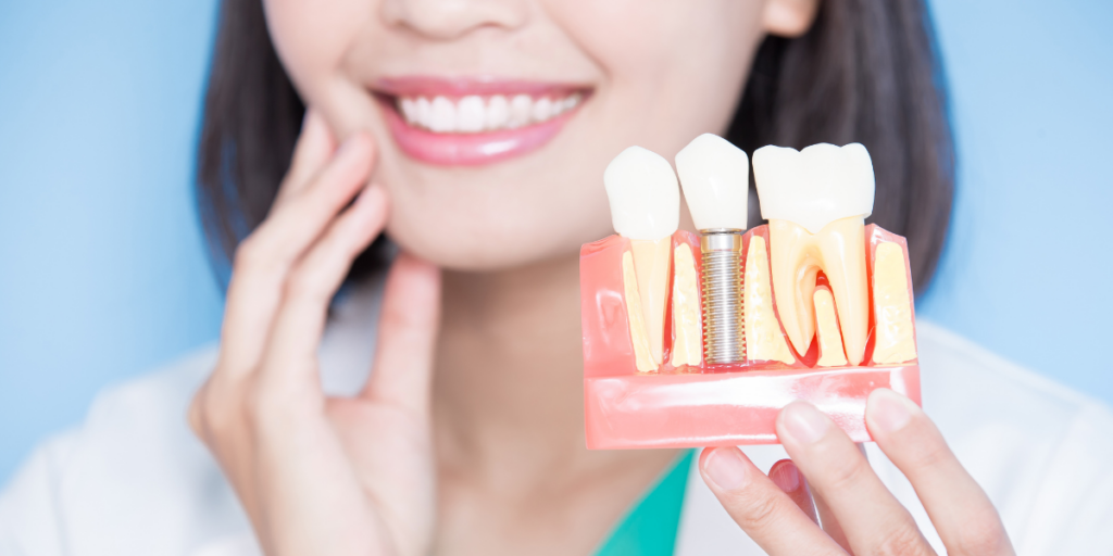 Success Rates Of Implants In Patients With Osteoporosis