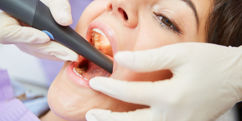 How Early Orthodontics May Help Reduce The Risk Of Root Canals
