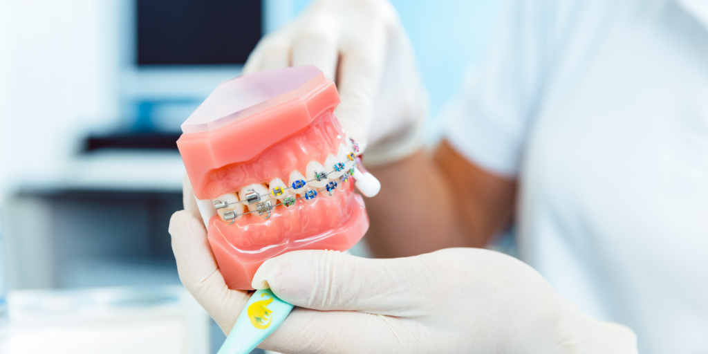 Orthodontic Treatment Options Available In Miami Beach
