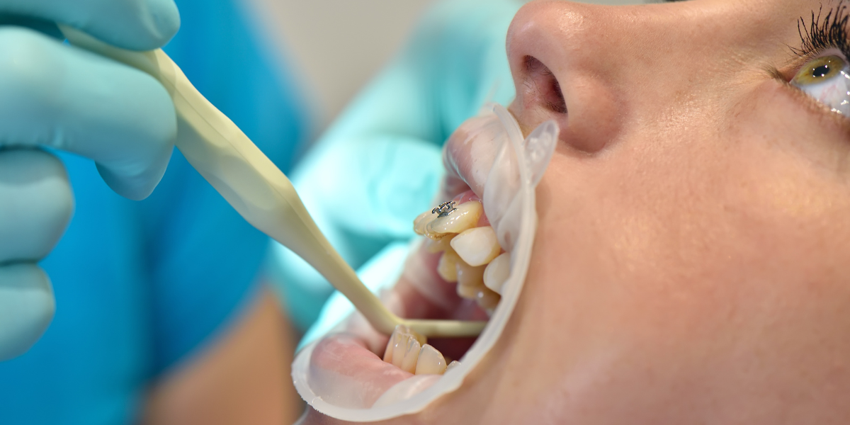 What Is Holistic Dentistry and Why Are Patients Choosing It