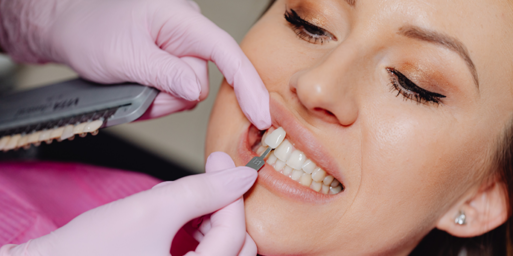 Can You Get Veneers For Crooked Teeth?